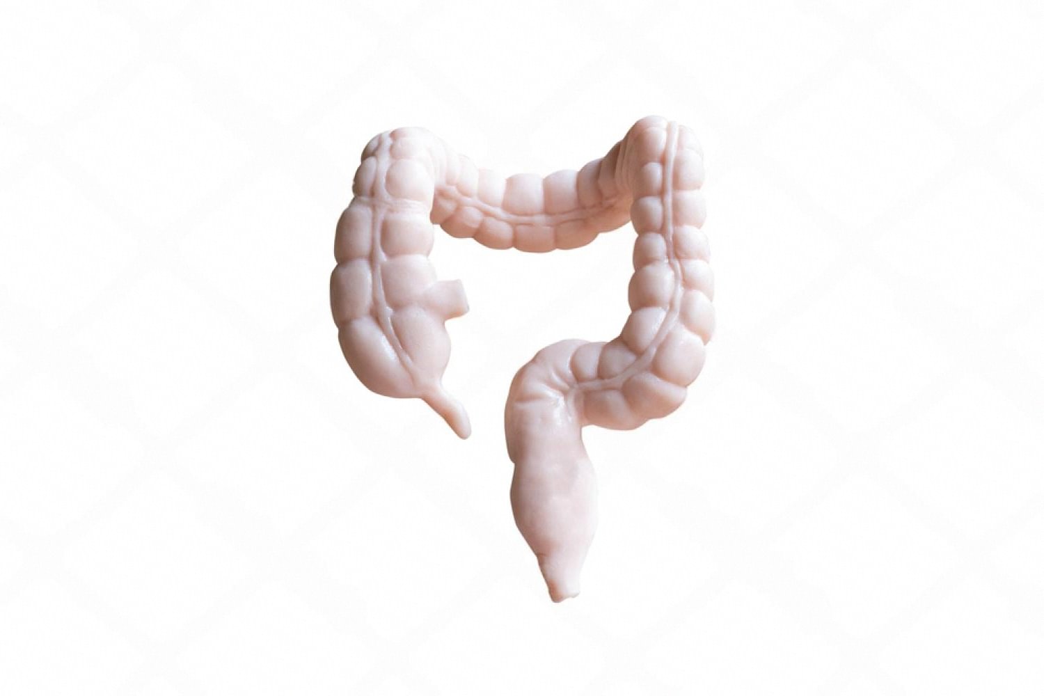 Anatomical model of the human colon used to explain colorectal cancer screening